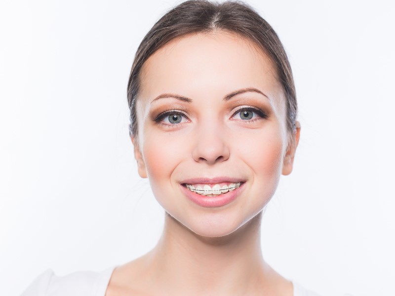 Orthodontic braces for teens in Buffalo Grove, IL